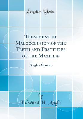 Full Download Treatment of Malocclusion of the Teeth and Fractures of the Maxill�: Angle's System (Classic Reprint) - Edward H. Angle file in PDF